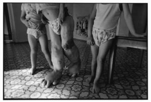 Дети Рожденные После Чернобыльской Аварии Статус